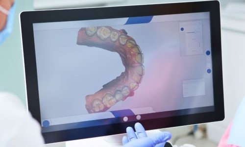 Transforming Smiles with 3D Scanning in Tanzania