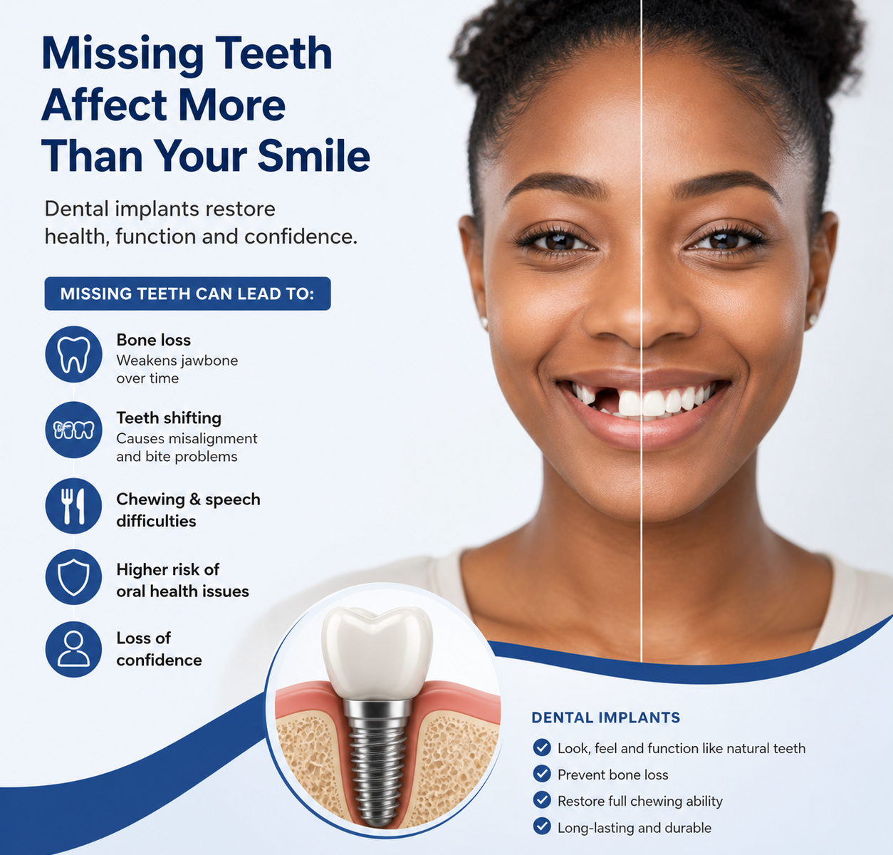 Missing Teeth
