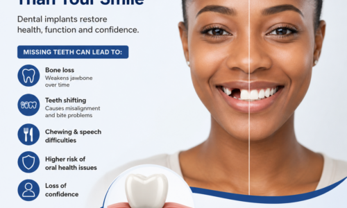 Missing Teeth