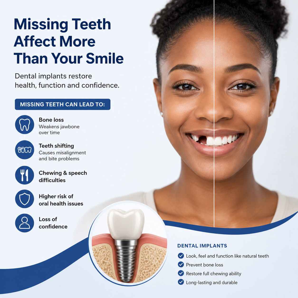 Missing Teeth